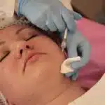 Maximize Your Reach: PPC Success for Sarasota & Bradenton Dermatologists