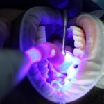 Beyond the Chair: Attract More Patients with Innovative PPC Strategies for Bradenton Dentists