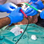 Local Focus, Big Impact: Elevate Your Sarasota Dental Business with Effective PPC Ads