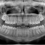 Smile Brighter Online: The Essential SEO Strategies for Bradenton Orthodontists