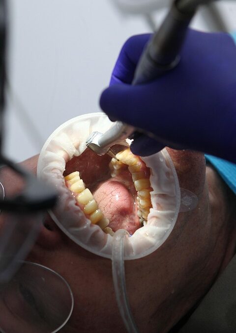 Boost Your Sarasota Practice: How PPC Can Put Your Dental Services in the Spotlight!