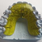 Digital Dentistry: Harnessing PPC to Connect Sarasota Residents with Their Next Favorite Dentist!