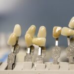 SEO for Smiles: Transforming Your Sarasota Dental Practice into a Community Favorite!