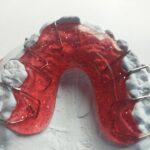 Smile Bright: How SEO Can Put Your Bradenton Dental Practice on the Map