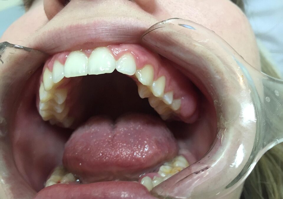 Unlocking Success: How SEO Can Transform Your Bradenton Dental Practice